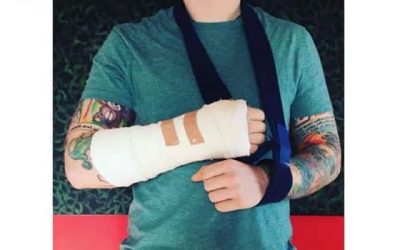 Ed Sheeran Injures Both Arms in Bicycle Accident; Seven Asia Dates Dropped